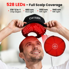 CAYAMA cap focuses light on crown, enabling balanced scalp exposure.