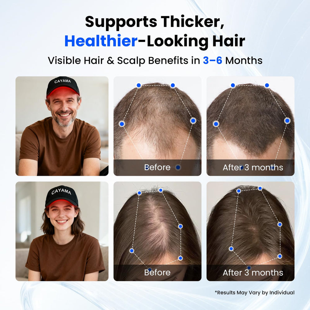 CAYAMA Red Light Hair Growth Cap enables cordless use during everyday activities