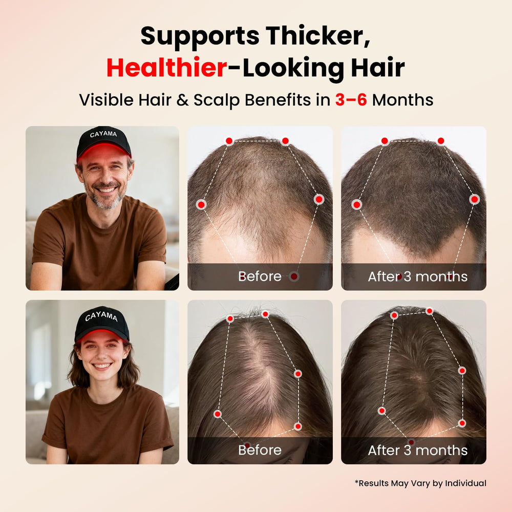 CAYAMA cap highlights crown area therapy for balanced scalp treatment
