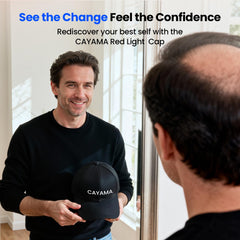 CAYAMA Red Light Hair Growth Cap focuses on the crown to encourage even exposure