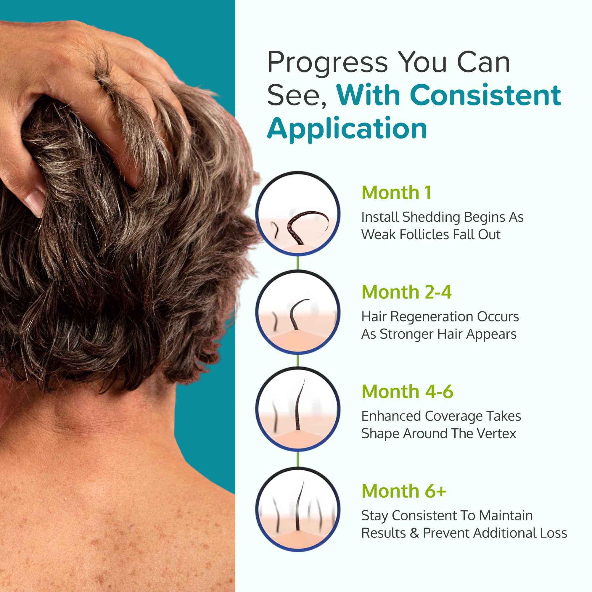 Concept of potential hair coverage with C'rcle Minoxidil Foam 5% unscented