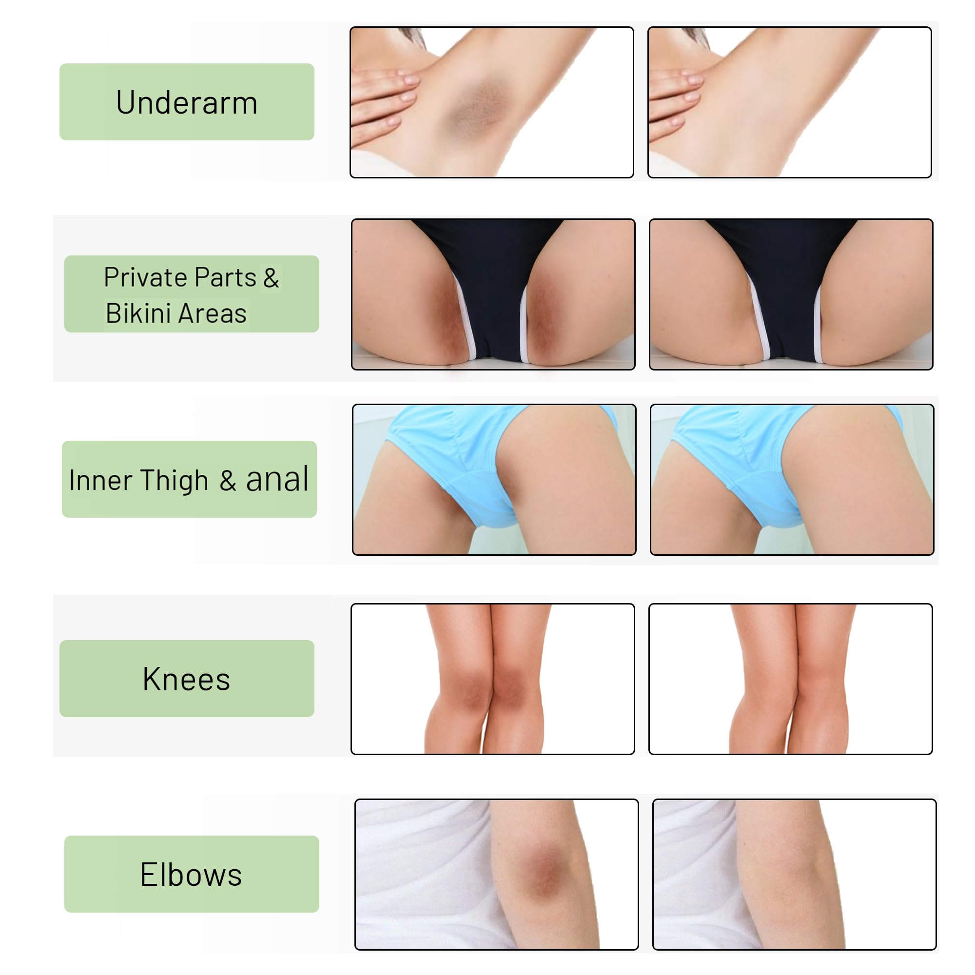 Ceavo Intimate Areas Cream application close-up for precise daily use