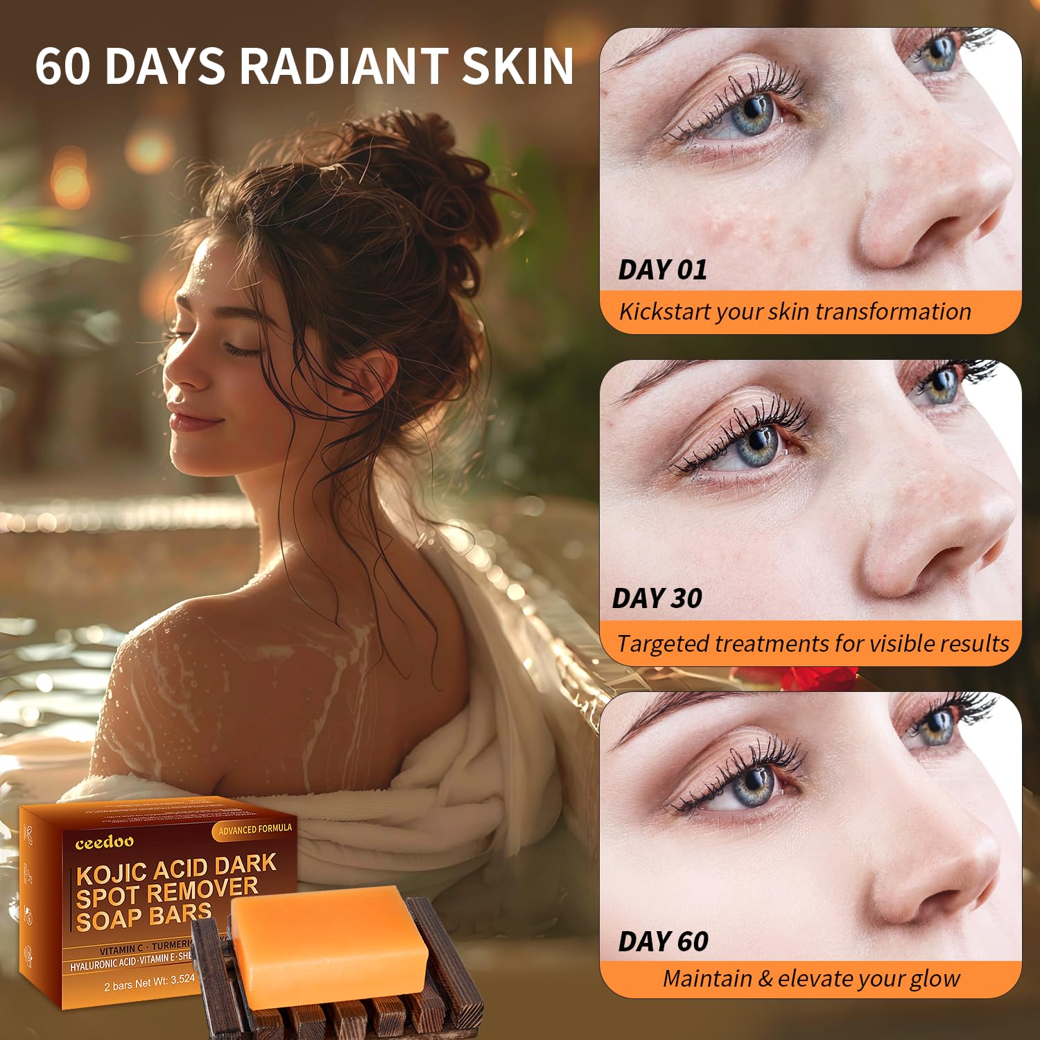 Ceedoo Kojic Acid Soap with vitamin C and retinol enhances radiance during cleansing.