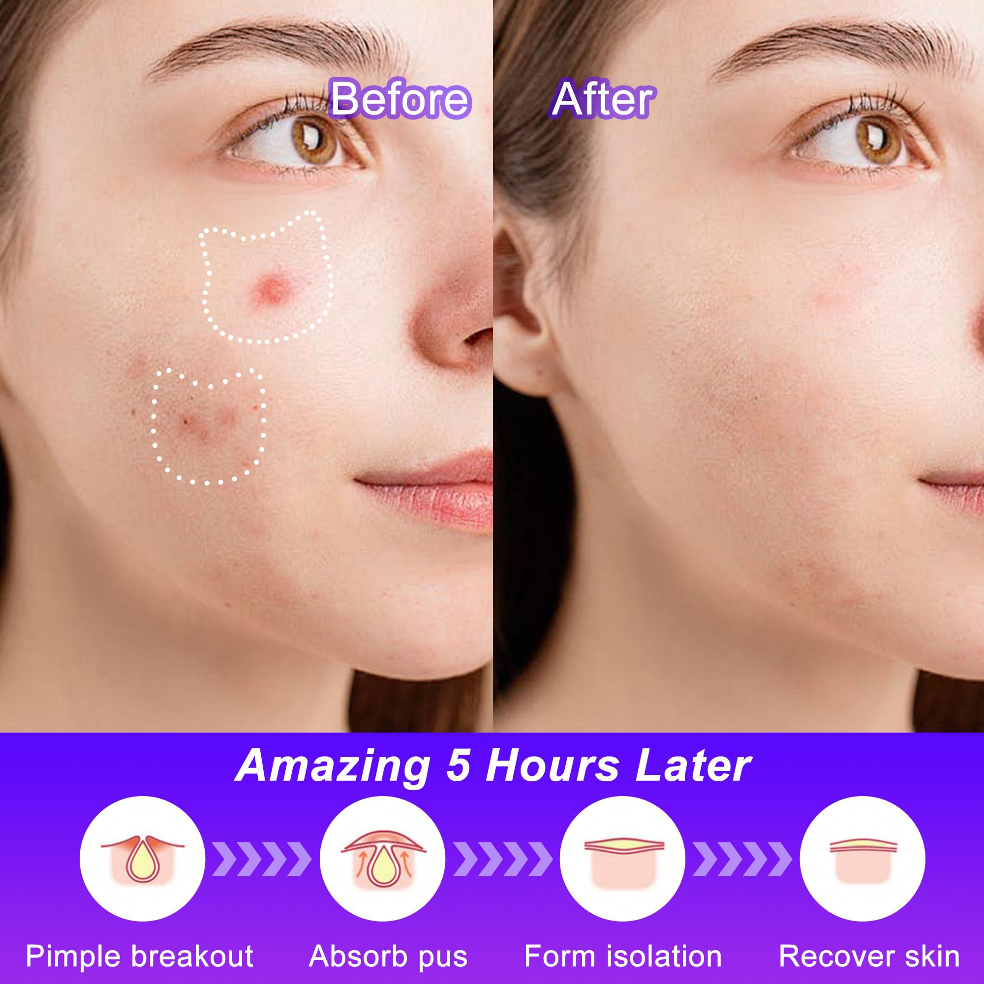 CELECARE uses tea tree oil and salicylic acid for skin care.