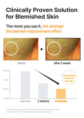 Celimax Pore+Dark Spot Serum Niacinamide 5% supports even skin tone