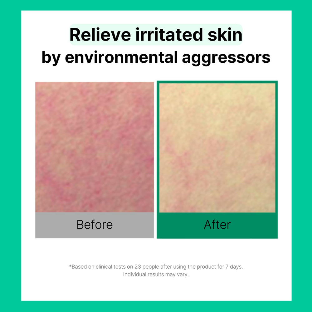 Cell Fusion C Post Alpha CICA Toner Pad — Relaxation des rougeurs et peau calme.