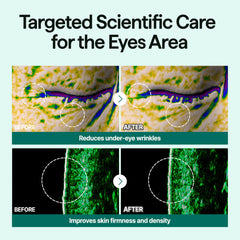 CELL IN SHOT Eyebanding Shot near the eye area during application