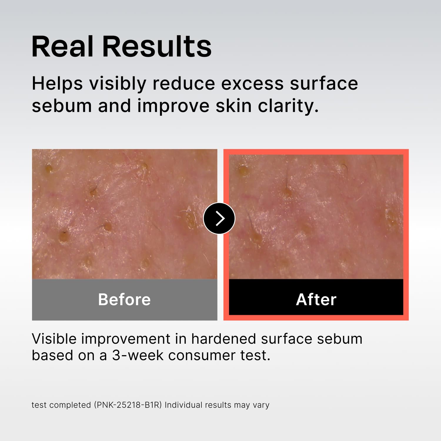 Celladix Ampoule supports skin barrier with lipid-rich blend visuals.