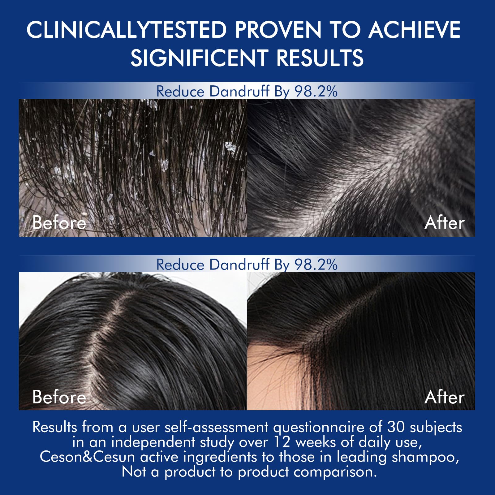 Ceson&Cesun rosemary biotin shampoo bottle with rosemary sprigs.
