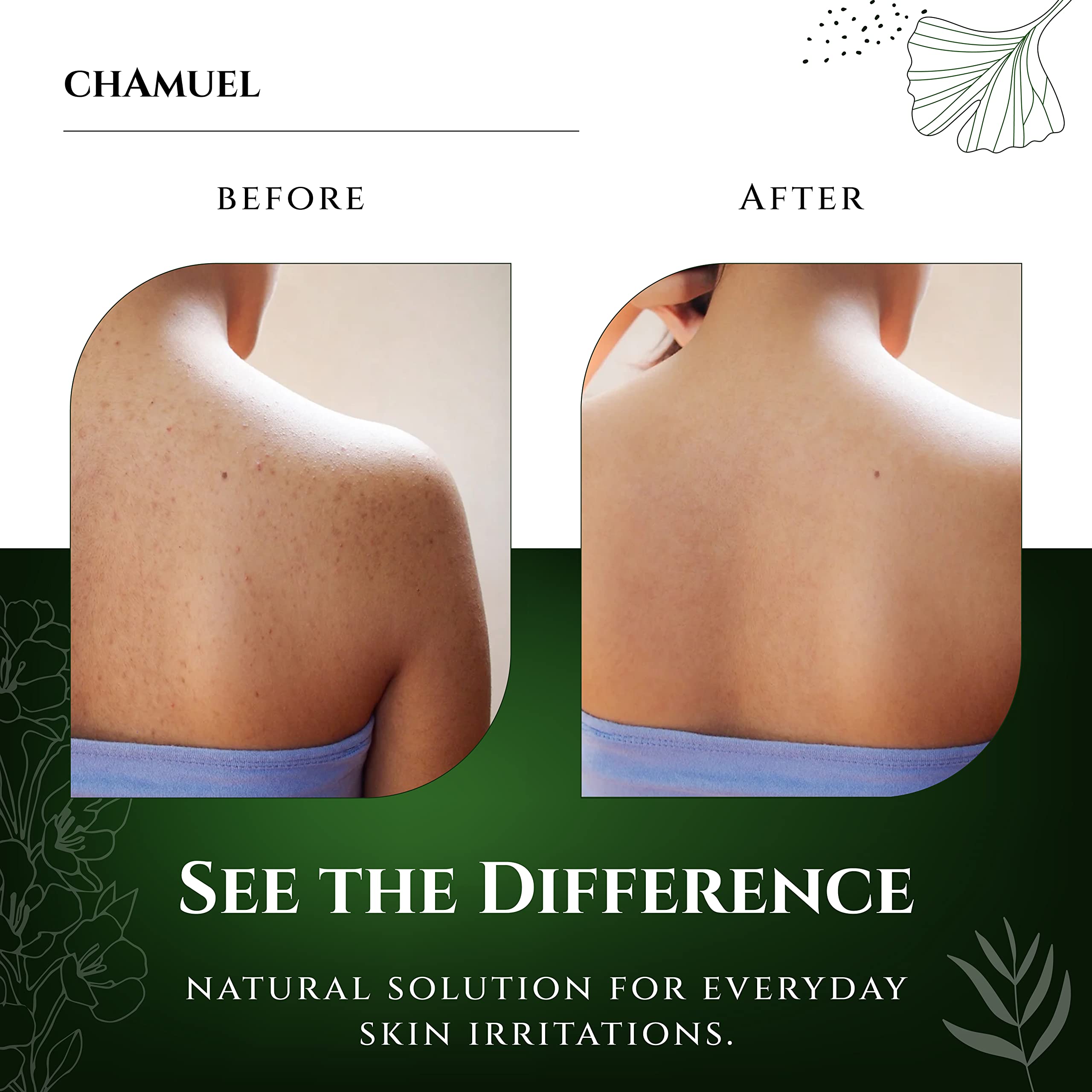Chamuel Tea Tree Body Wash label detail emphasizes plant-based formula.
