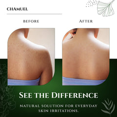 Chamuel Tea Tree Body Wash label detail emphasizes plant-based formula.