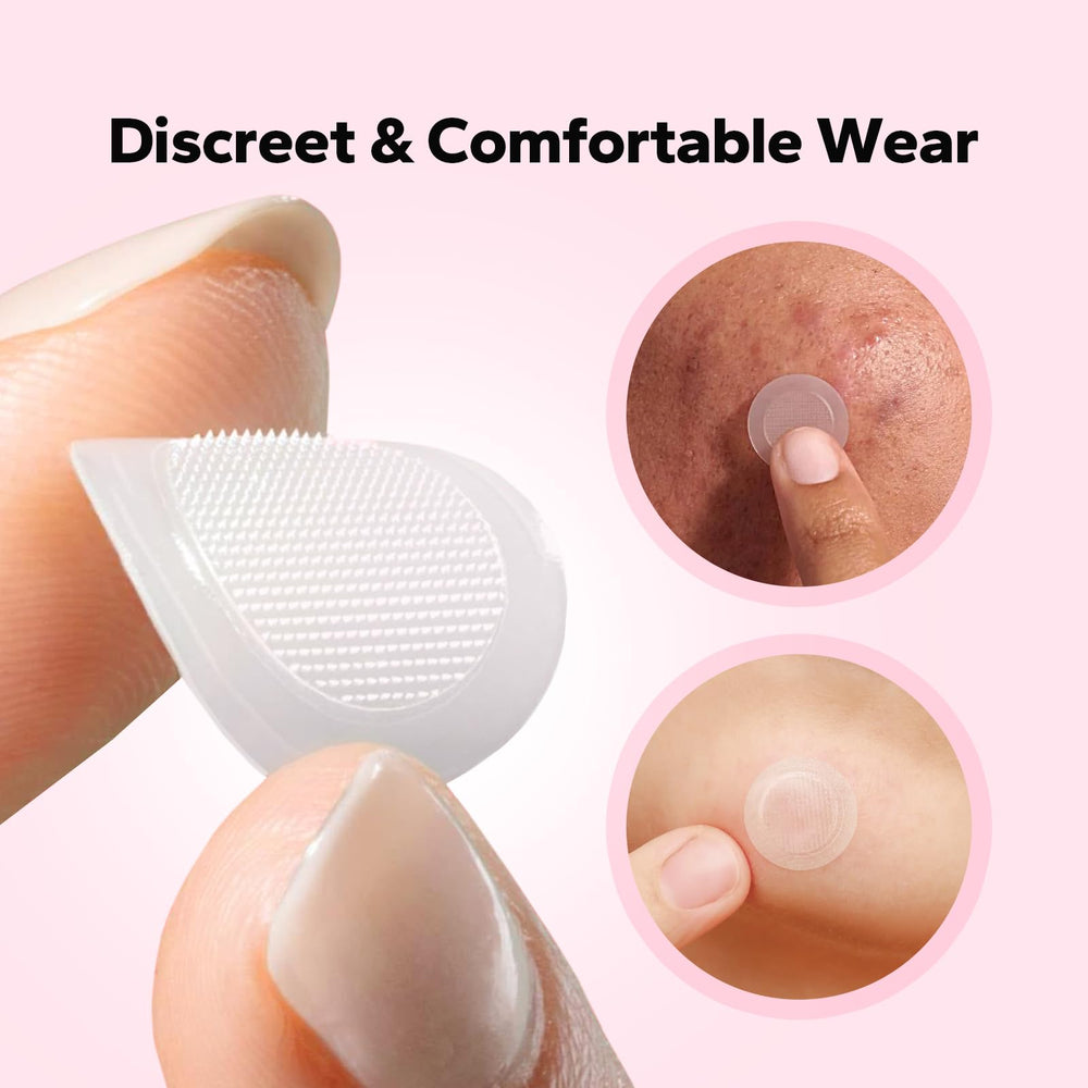 CharmCherry overnight wear patch adheres securely for uninterrupted blemish care.
