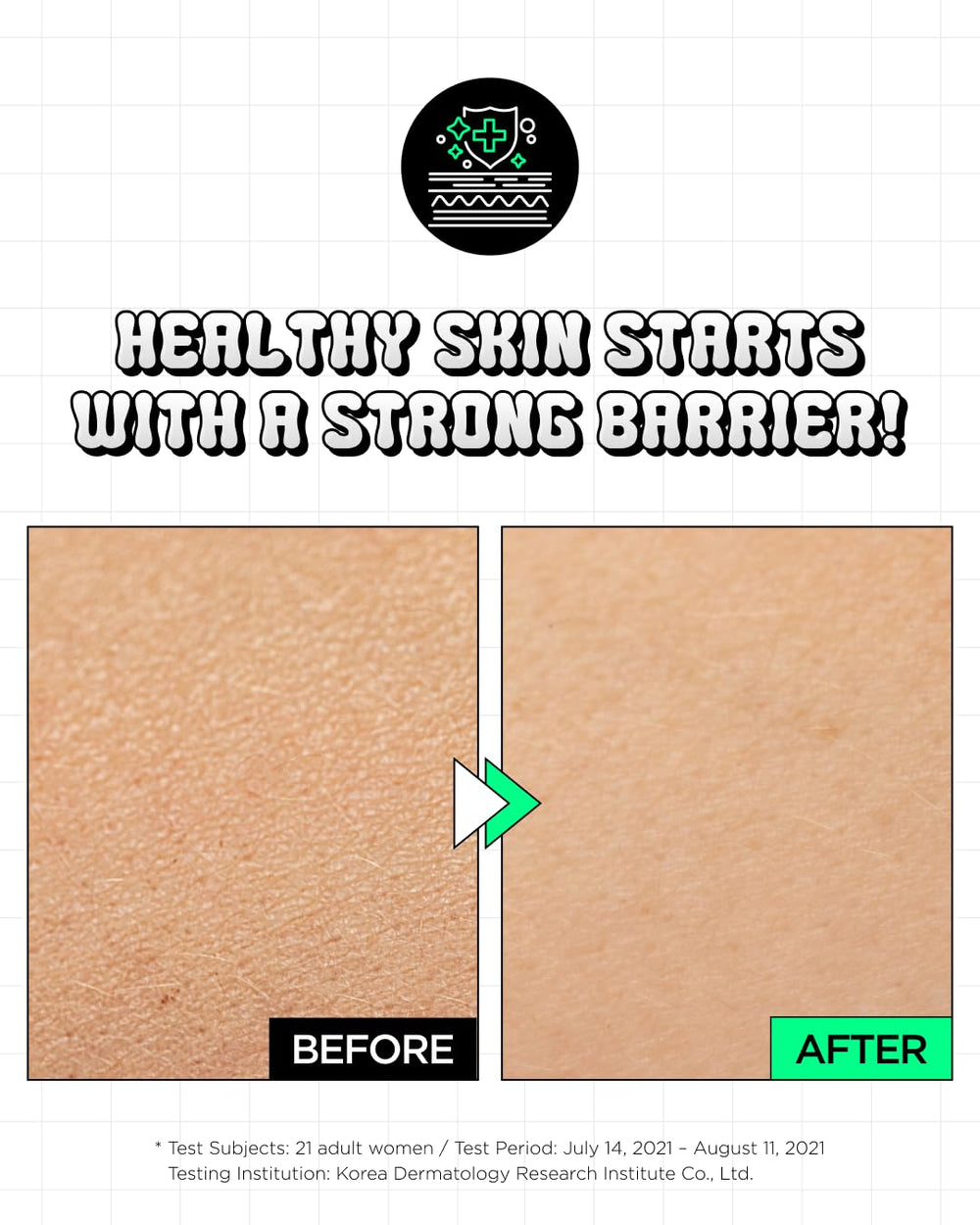 CHASIN' RABBITS Green Golden Ruler probiotics icon emphasizes barrier-supporting ingredients.