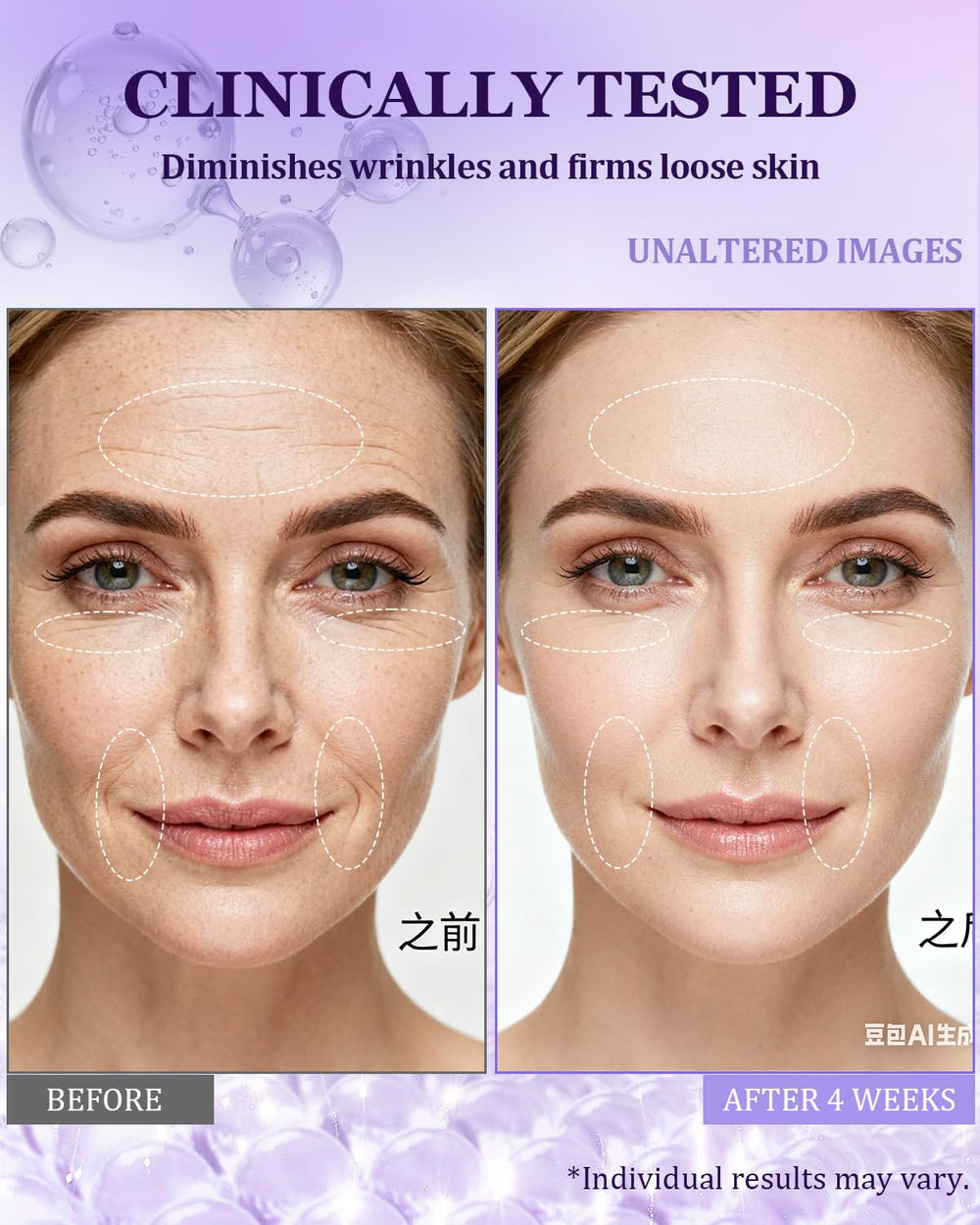CHEOKINGBA 1percent retinol formula close-up signals anti-aging potential.