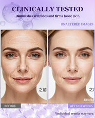 CHEOKINGBA 1percent retinol formula close-up signals anti-aging potential.