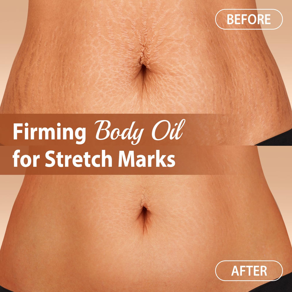CHEOKINGBA Body Firming Oil after-shower routine leaves skin soft and hydrated.