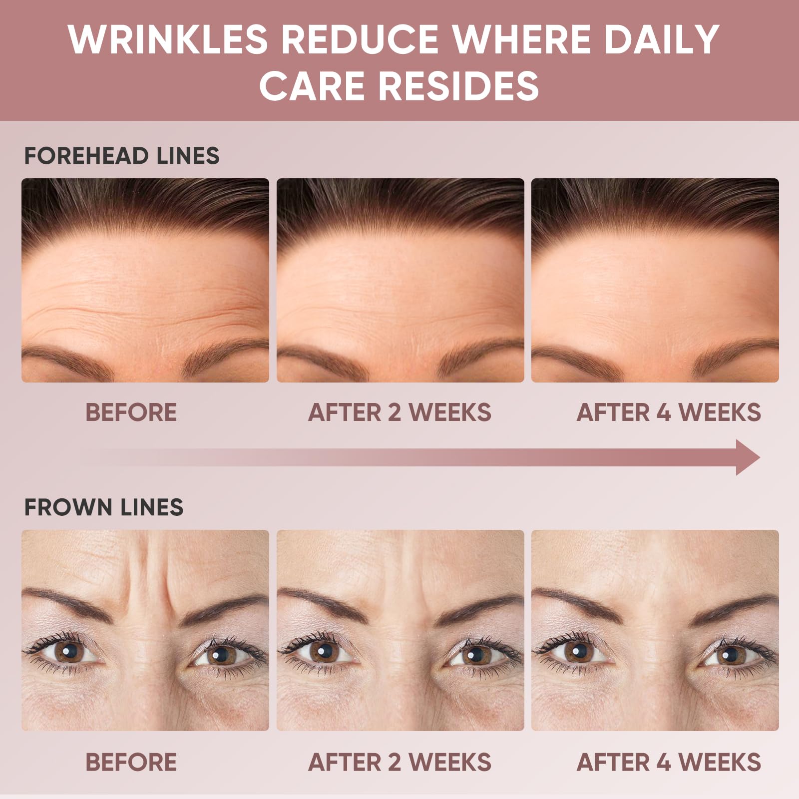 Chialing Forehead Wrinkle Patches apply overnight for restful skin care.