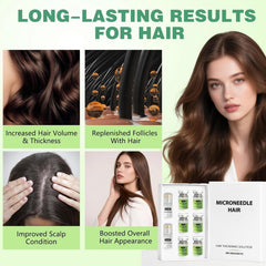 ChLNDalin Hair Growth System application on scalp demonstrates quick non-greasy absorption.
