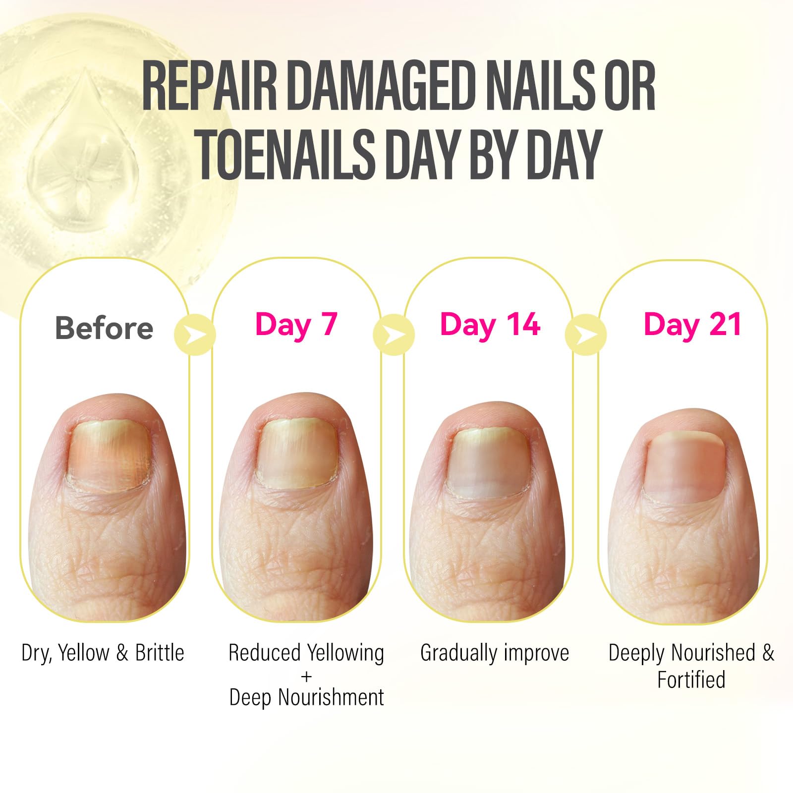 CHUCHU nails after use showing healthy-looking finish.