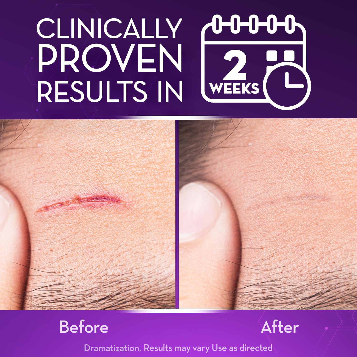 Cicatricure gel on skin demonstrates non-greasy finish during application.