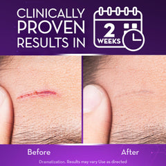 Cicatricure gel on skin demonstrates non-greasy finish during application.