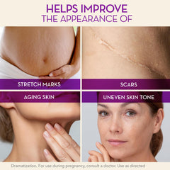 Cicatricure Cica Oil being applied to skin shows gentle massage for elasticity.