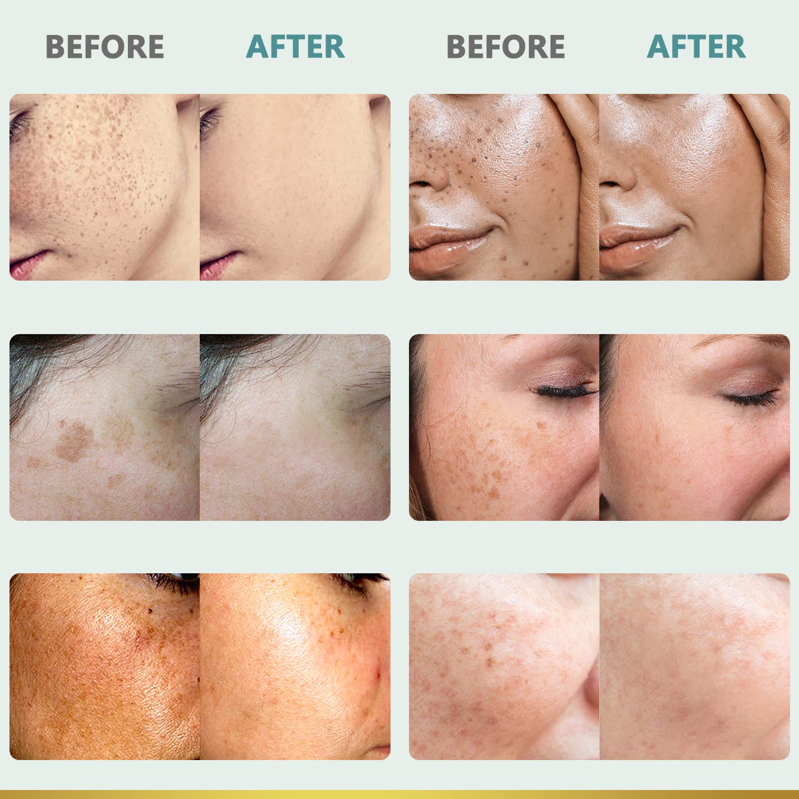 Hands applying CityGOO Dark Spot Remover demonstrates easy daily skincare routine.
