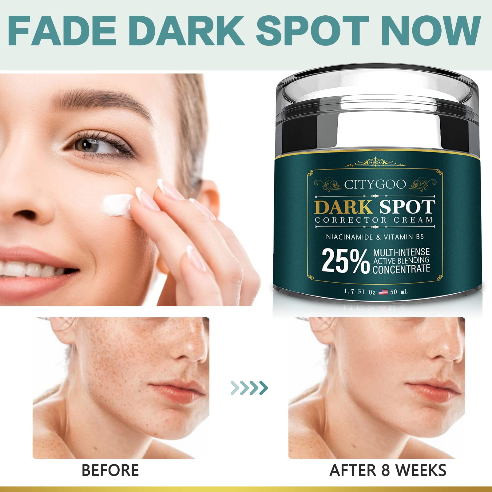 CityGOO Dark Spot Remover cream tube ready for targeted blemish correction.