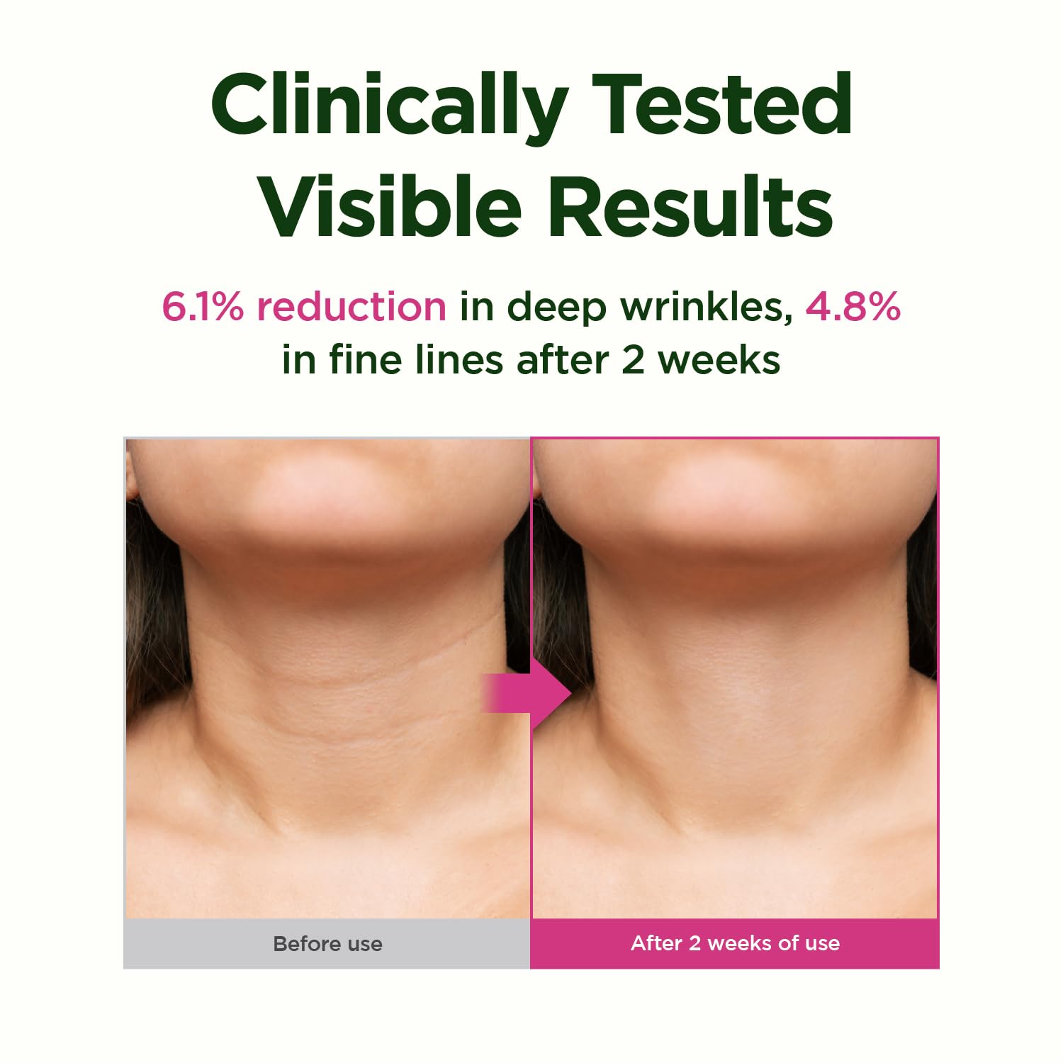 CKD Guaranteed gua sha neck roller detail during use