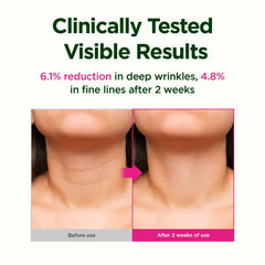 CKD Guaranteed gua sha neck roller detail during use