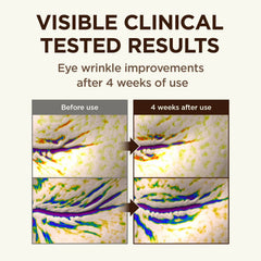 CKD Retinal 5X formula with glutathione and caffeine brightening the under-eye area