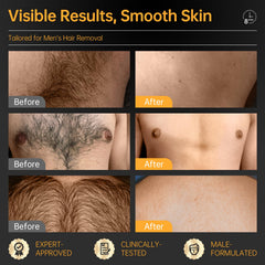 Spatula applying CKM hair removal cream for quick results