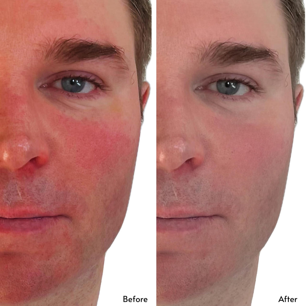 Clark's Botanicals Deep Moisture Mask applying on skin delivering calm, lasting moisture.