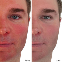 Clark's Botanicals Deep Moisture Mask applying on skin delivering calm, lasting moisture.