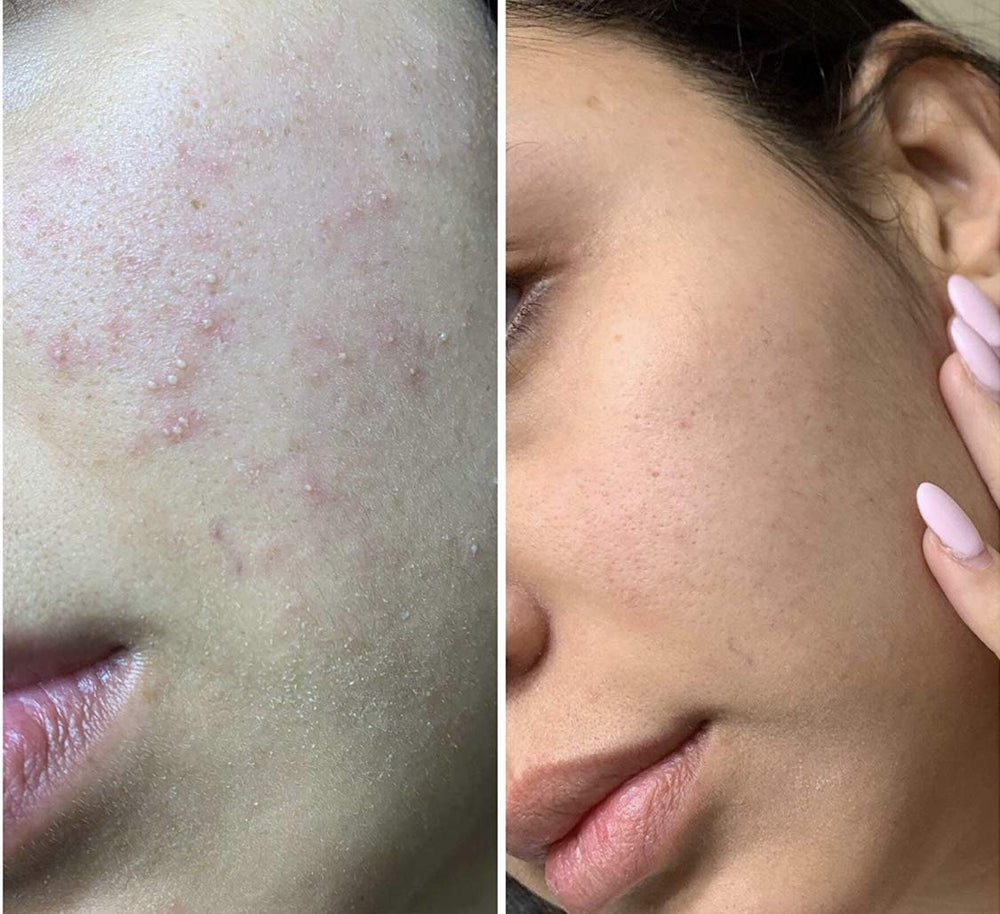 Toner being spread on skin showing smooth texture and even application with Class Gold