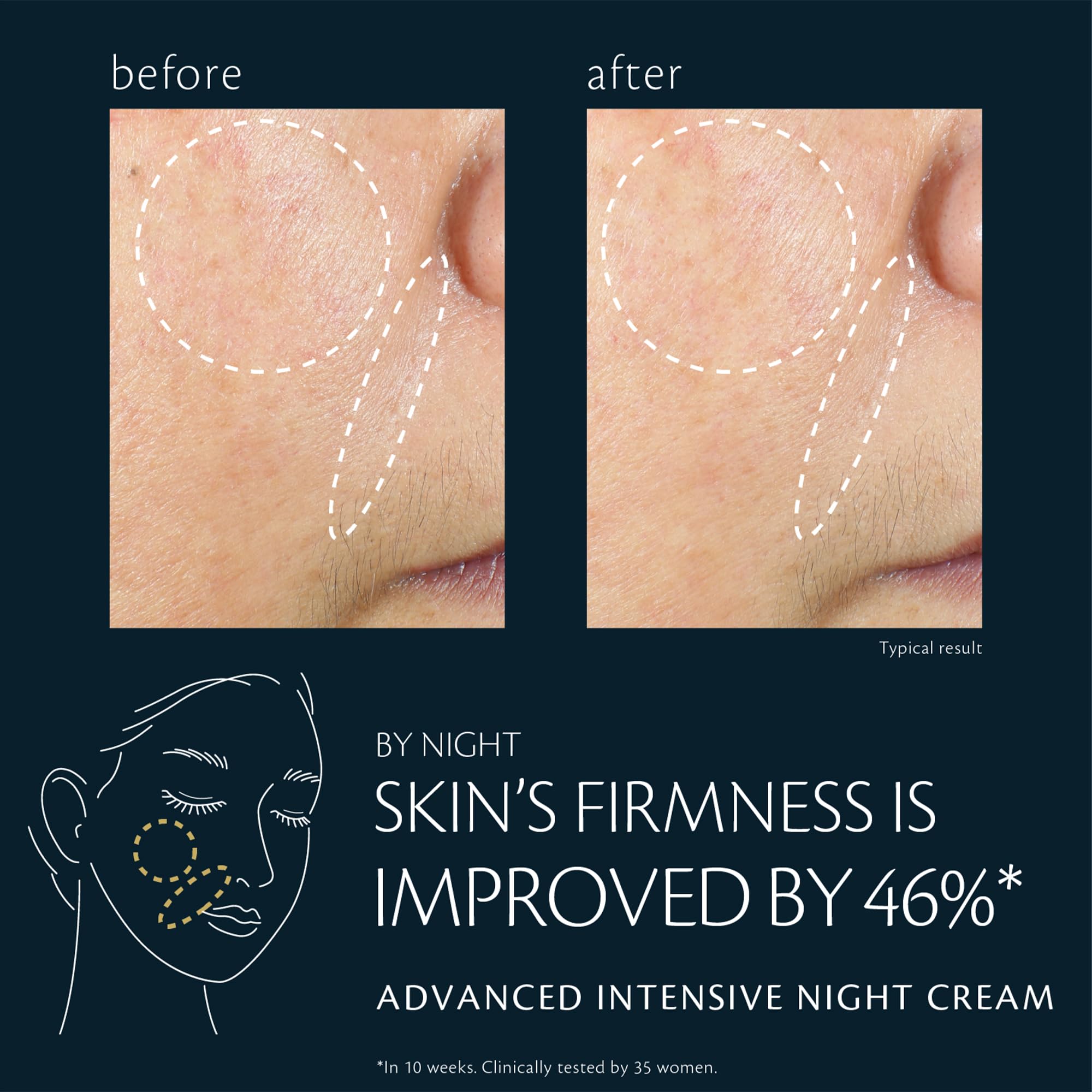 Refillable packaging of Clé de Peau Beauté Advanced Night Cream, supports sustainable skincare.