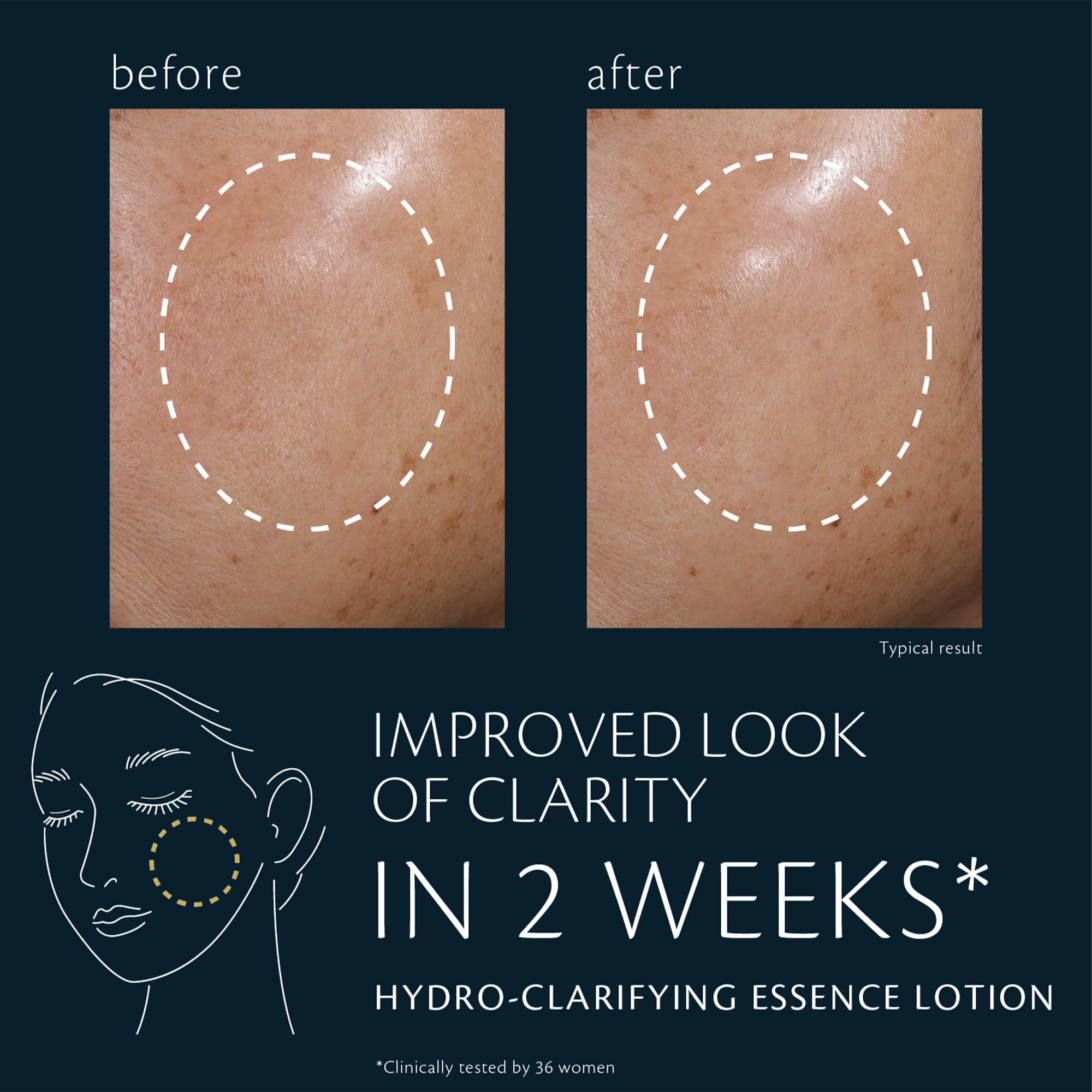Application moment shows smooth skin surface after one use
