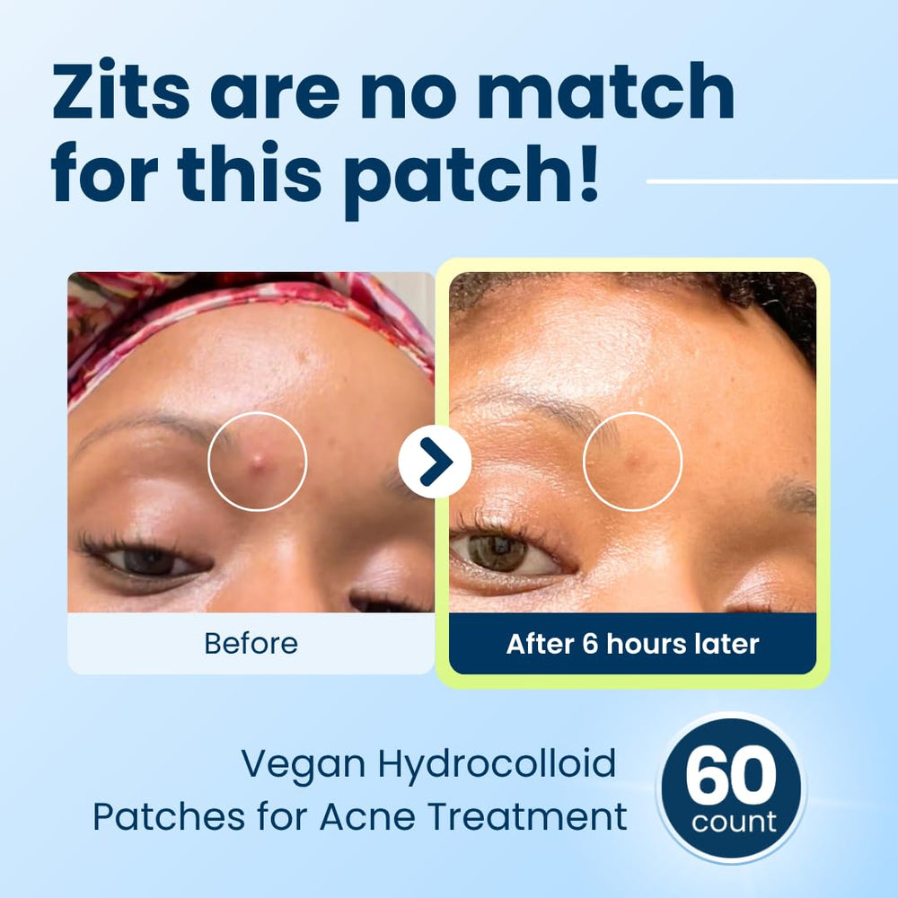 Clear patch on face blends with tone for day use