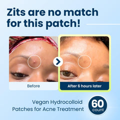 Clear patch on face blends with tone for day use