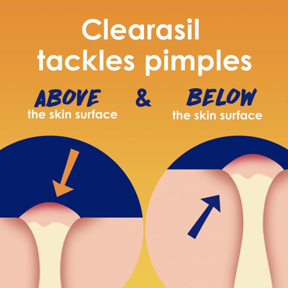 Clearasil pads points noirs et imperfections visibles s’atténuent