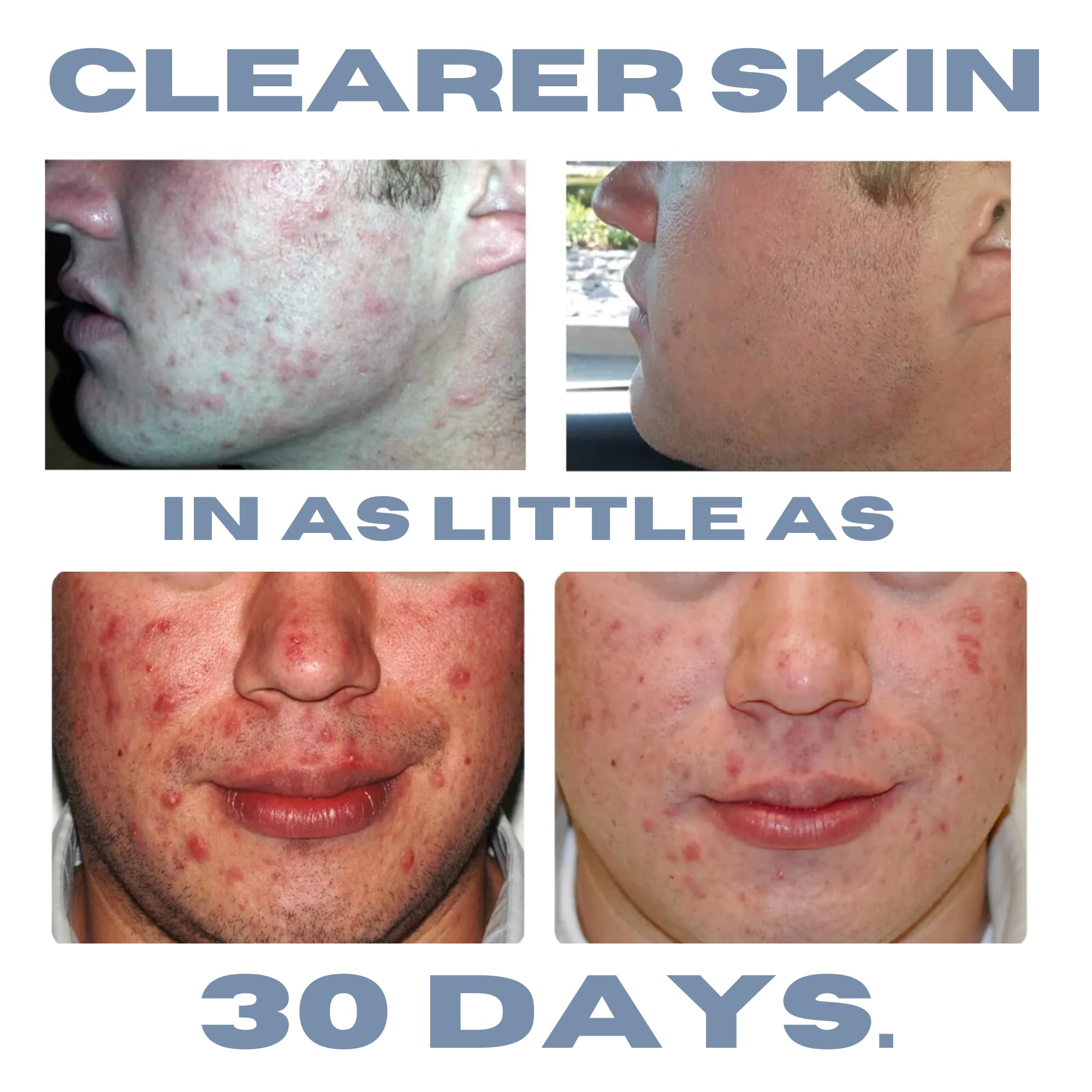 Clearogen lotion packaging label highlighting paraben-free formula