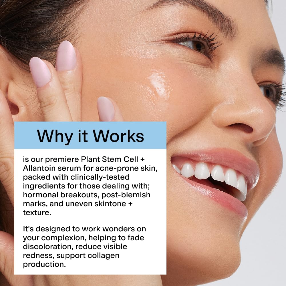 CLEARSTEM CELLRENEW turmeric-b5 combo signals anti-irritation benefits with calm skin.