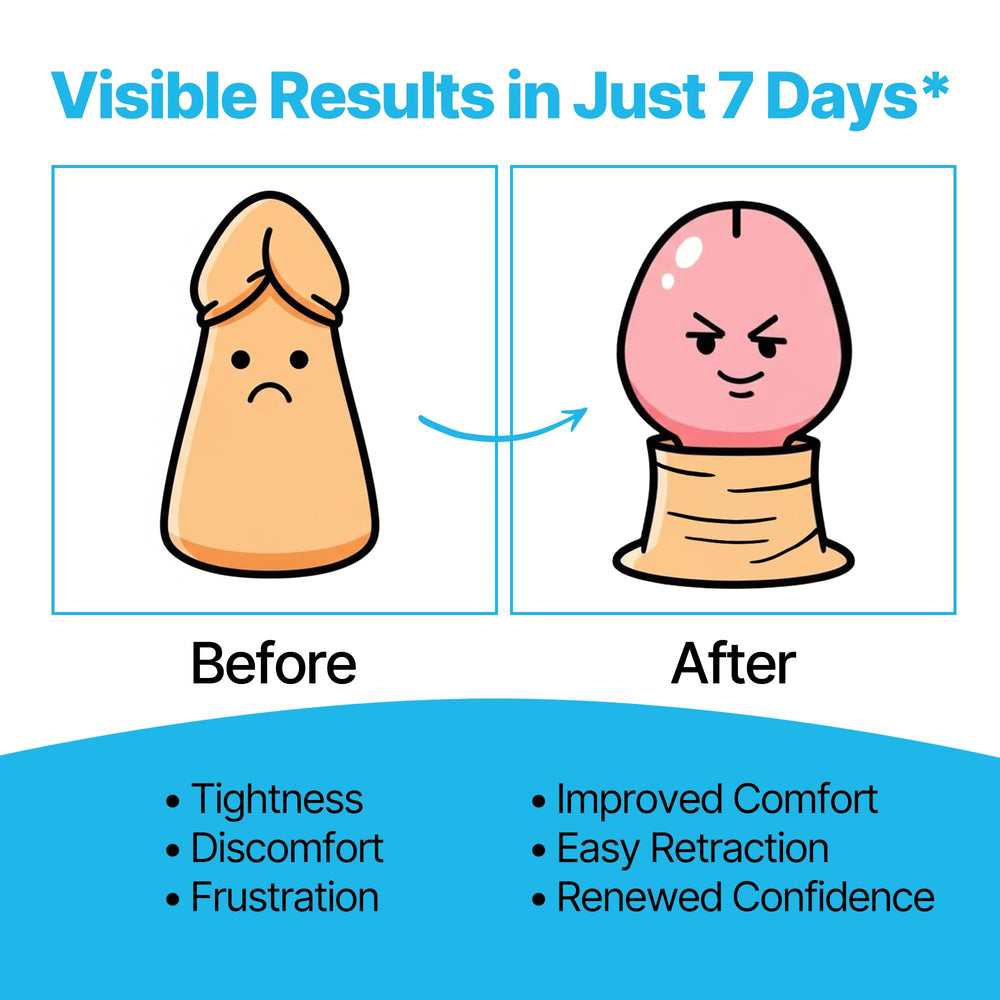 Clidelan foreskin care cream applied on skin showing gentle application.