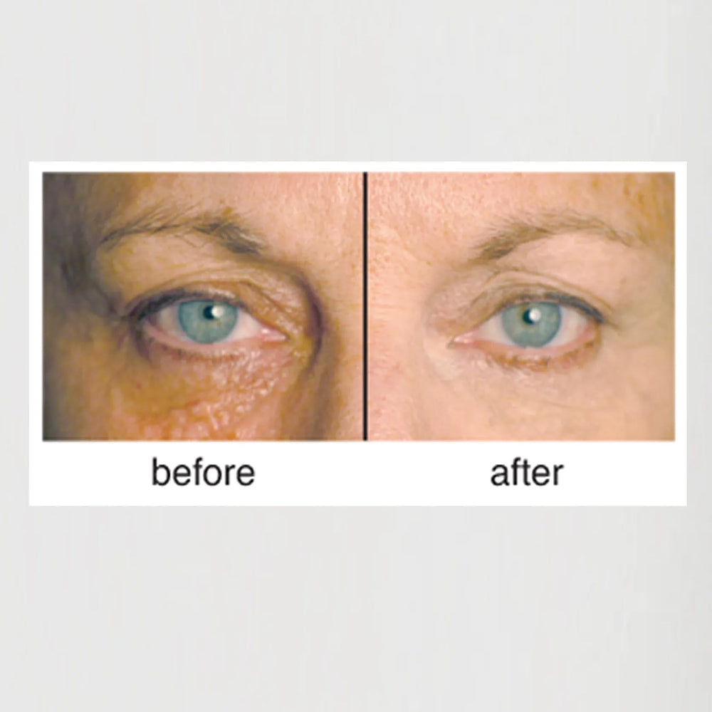 Clientele peptide wrinkle concealer compact neutral texture close-up for natural finish.
