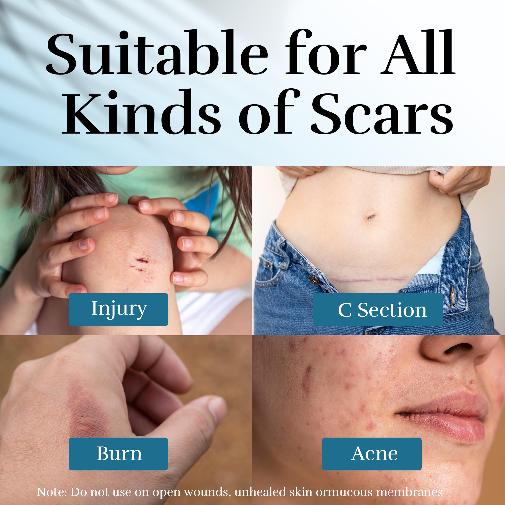 CLNABFR dermatologist-approved formula bottle highlights safety for sensitive skin