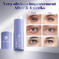 Applying CLNABFR eye stick to the under-eye area for treatment