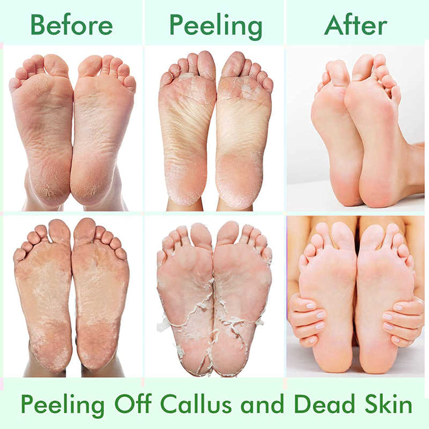 CMWGKBC Foot Peel Mask before-after shows potential skin renewal.
