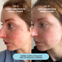 Cream gliding over skin to promote balanced, non-greasy hydration.