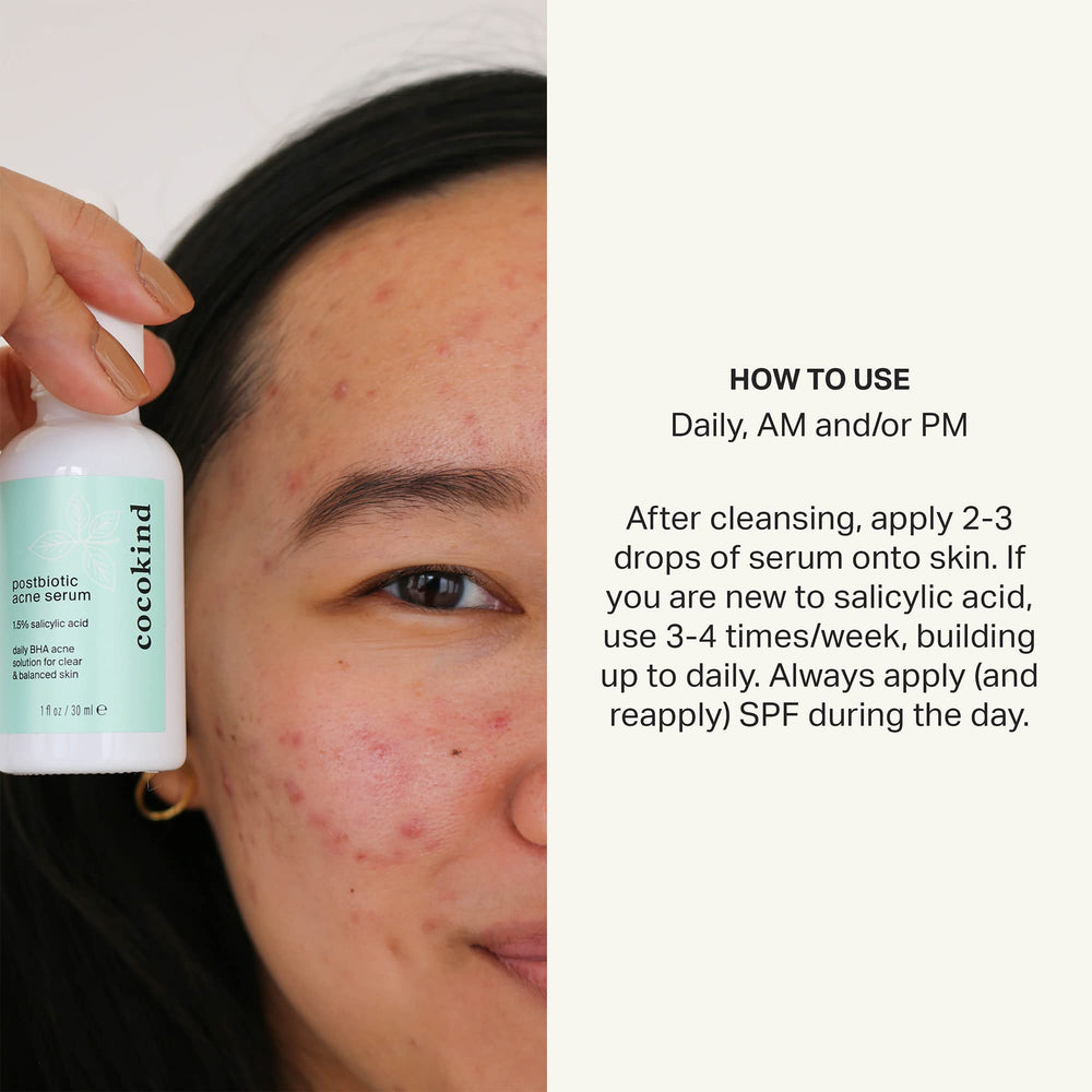 Cocokind Postbiotic Acne Serum application demonstrates easy daily use in routines.