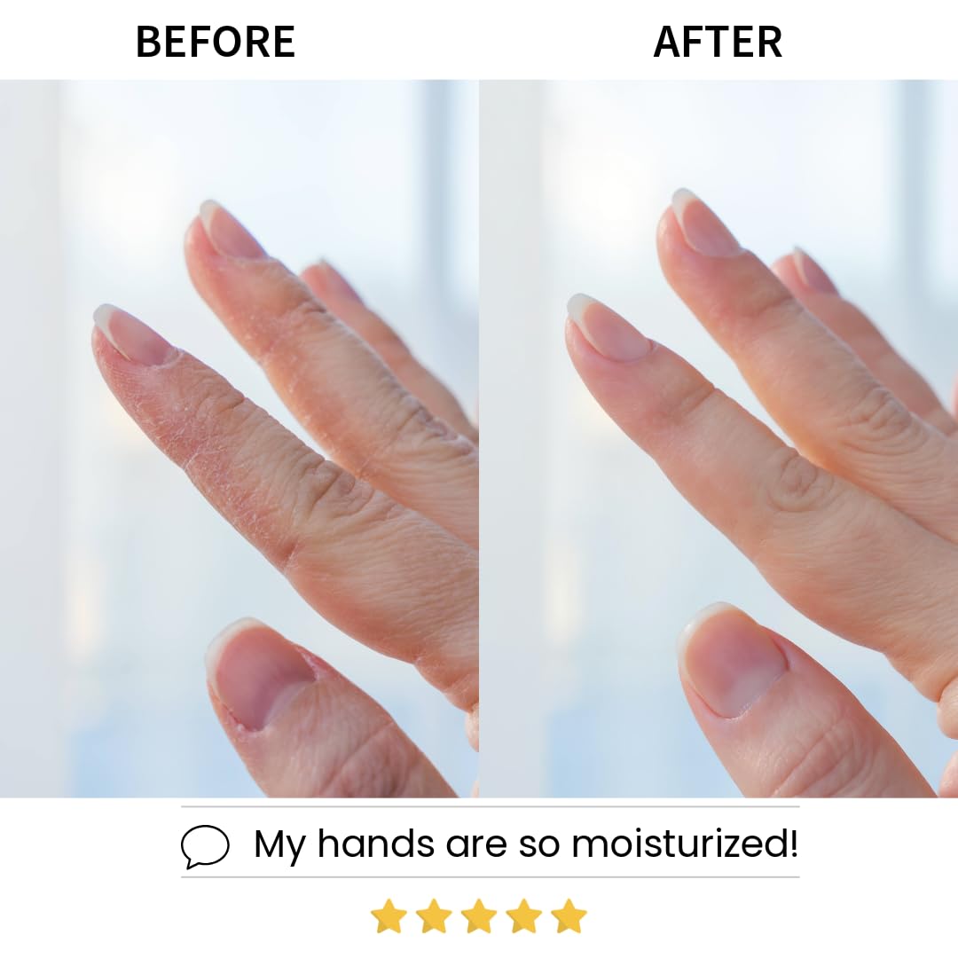 Hydrated, smooth hands with Codi New York hand mask for rough skin